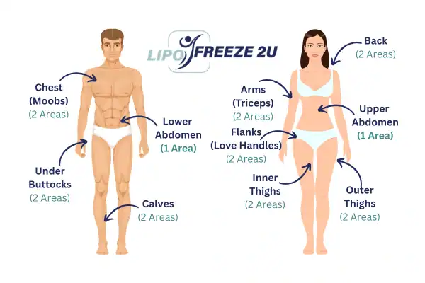 Areas you can have fat freezing treatment Hereford