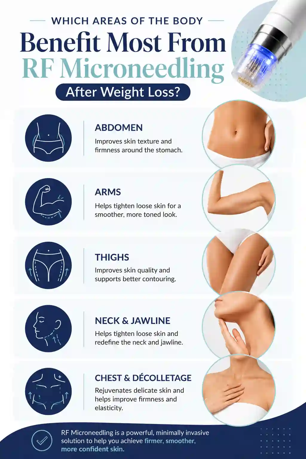 Which Areas of the Body Benefit Most From RF Microneedling After Weight Loss Hereford